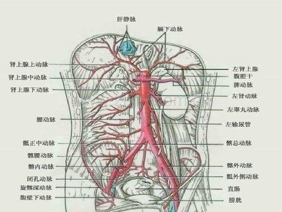 腹主动脉瘤的护理(讲课)ppt课件.ppt_第3页