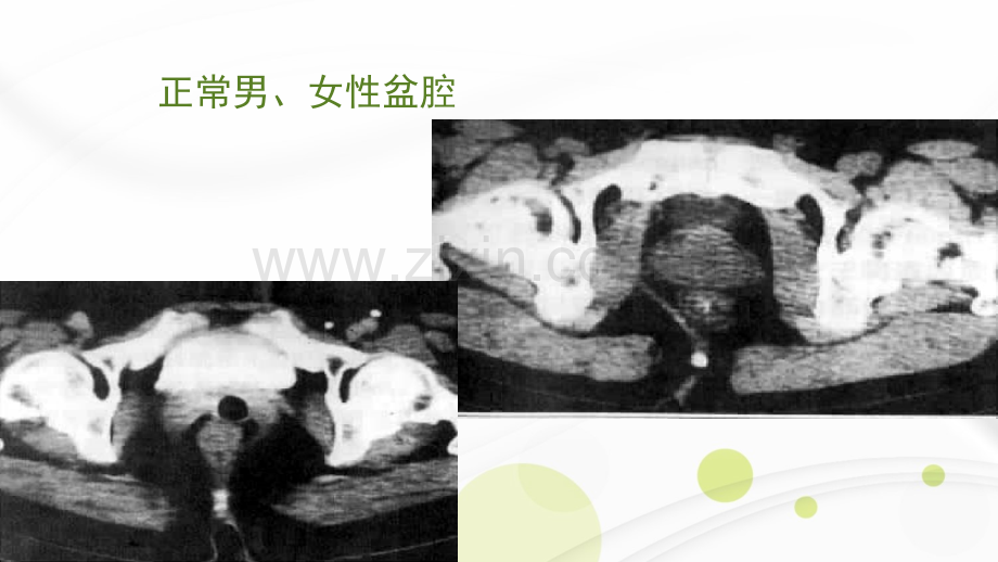 腹腔及腹膜后C诊断ppt课件.ppt_第2页