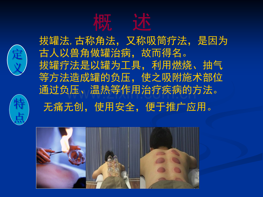 拔罐疗法.ppt_第2页