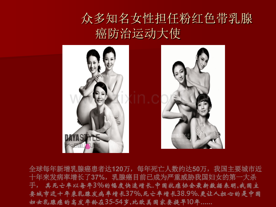 关注女性乳房ppt课件.pptx_第3页