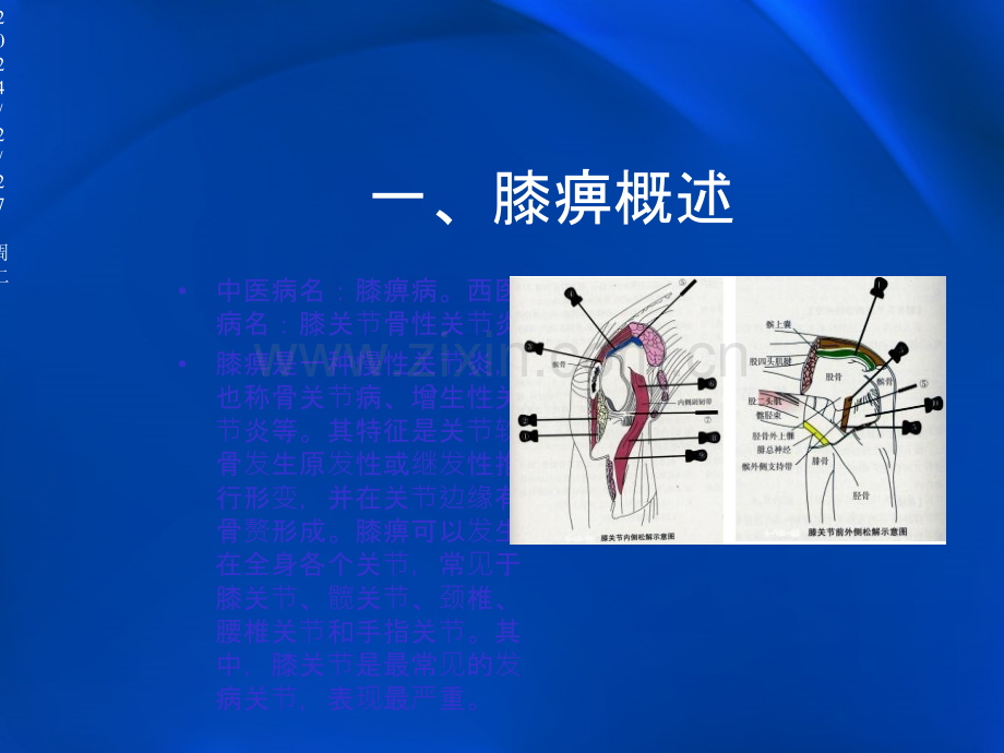 膝关节炎中医护理PPT.ppt_第3页