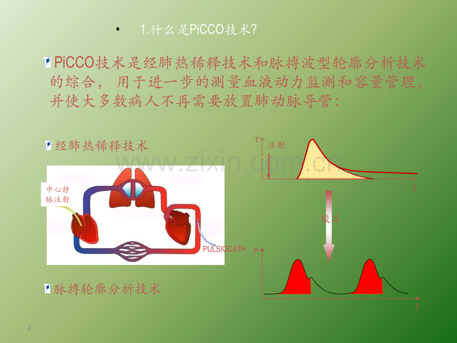 PiCCO基本原理ppt课件.ppt_第2页