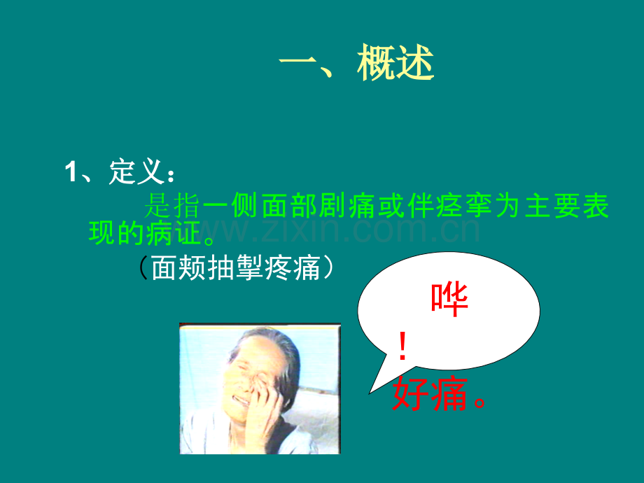 针灸学-面痛.ppt_第2页