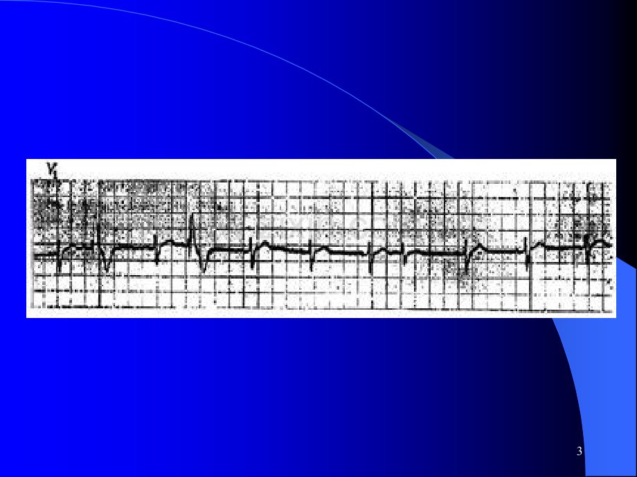 心律失常诊治ICUPPT课件.ppt_第3页
