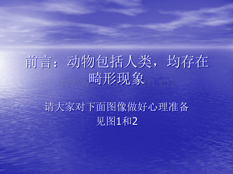 先天性骨关节畸形.ppt_第2页