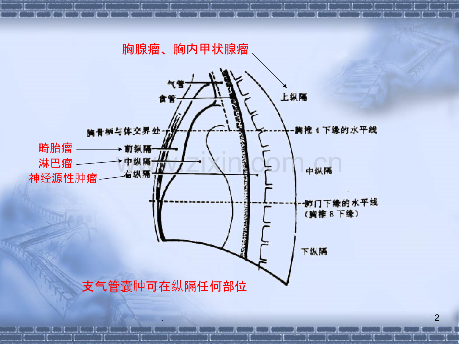 CT纵隔淋巴结分区PPT课件.ppt_第2页