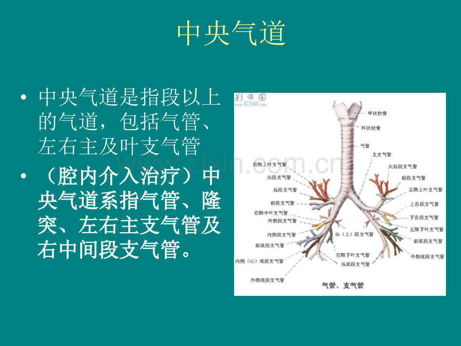 中央气道狭窄.ppt_第2页