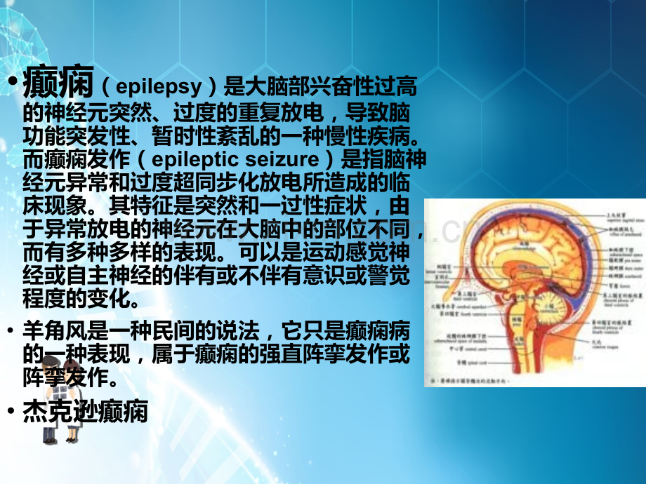 癫痫病人护理措施ppt课件.ppt_第2页