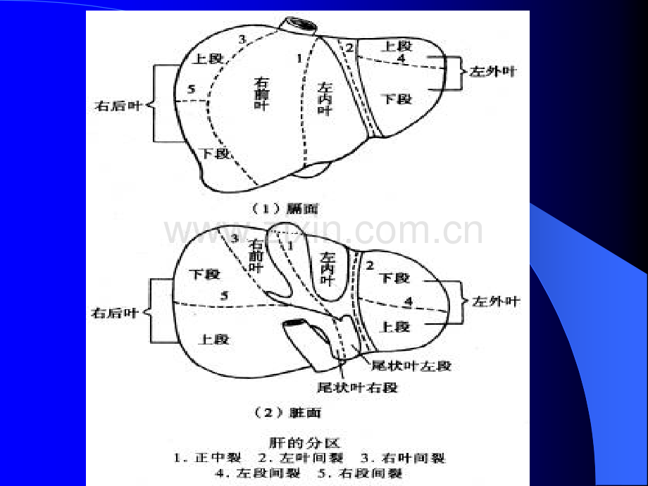 肝脏疾病病人的护理ppt课件.ppt_第3页