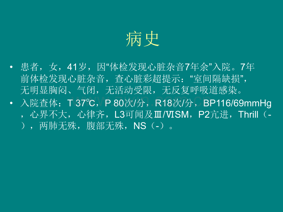 双伞封堵室间隔缺损ppt课件.pptx_第2页