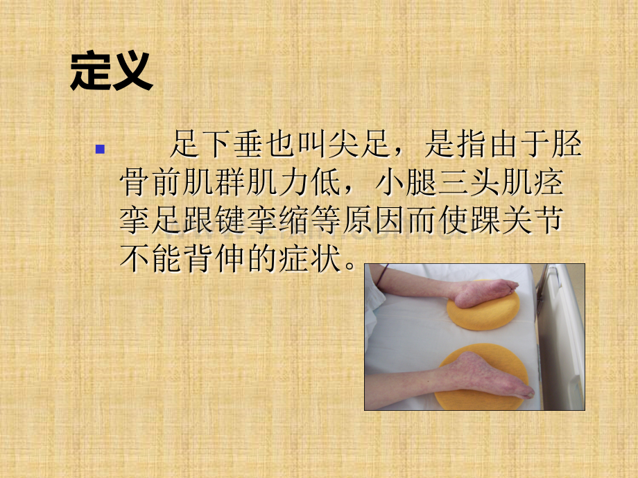 足下垂的预防与护理-.ppt_第3页