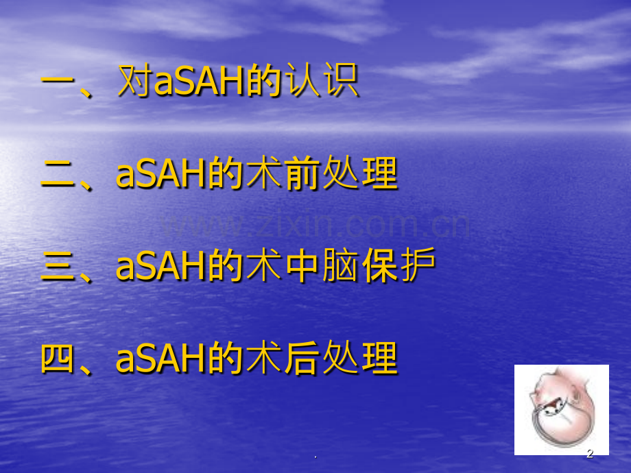 动脉瘤性蛛网膜下腔出血的围手术期处理讲座ppt课件.ppt_第2页