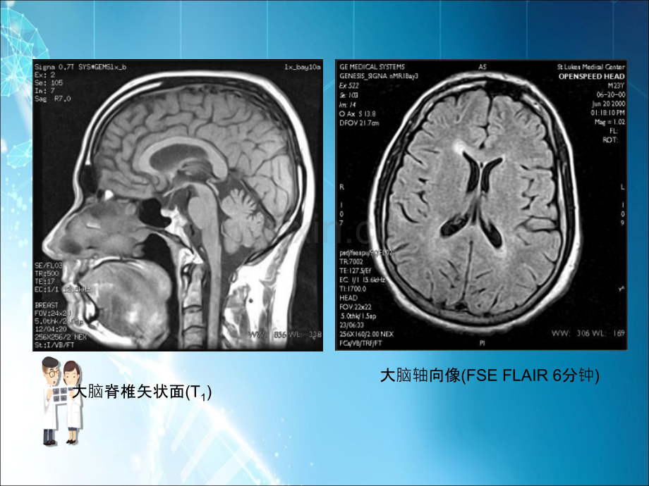 MRI图像脑ppt课件.ppt_第1页