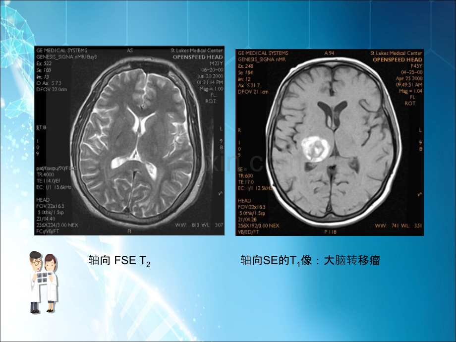 MRI图像脑ppt课件.ppt_第2页