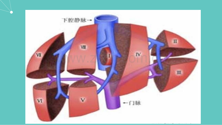 肝未分化肉瘤.ppt_第3页