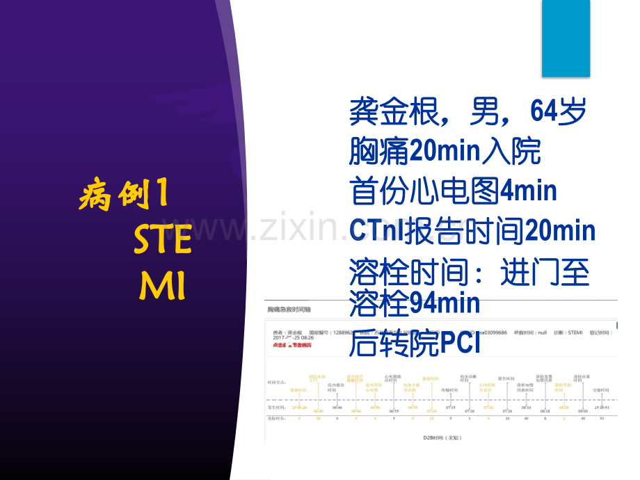 胸痛中心质量分析ppt课件.pptx_第2页