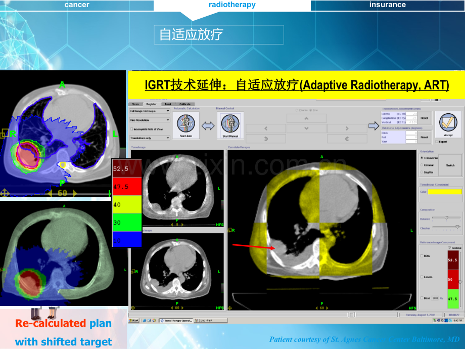 恶性肿瘤综合ppt课件.ppt_第1页