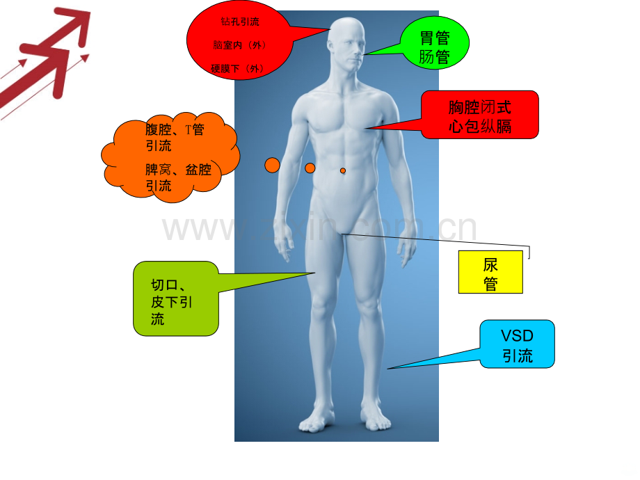 外科管常见引流管护理PPT课件.ppt_第3页