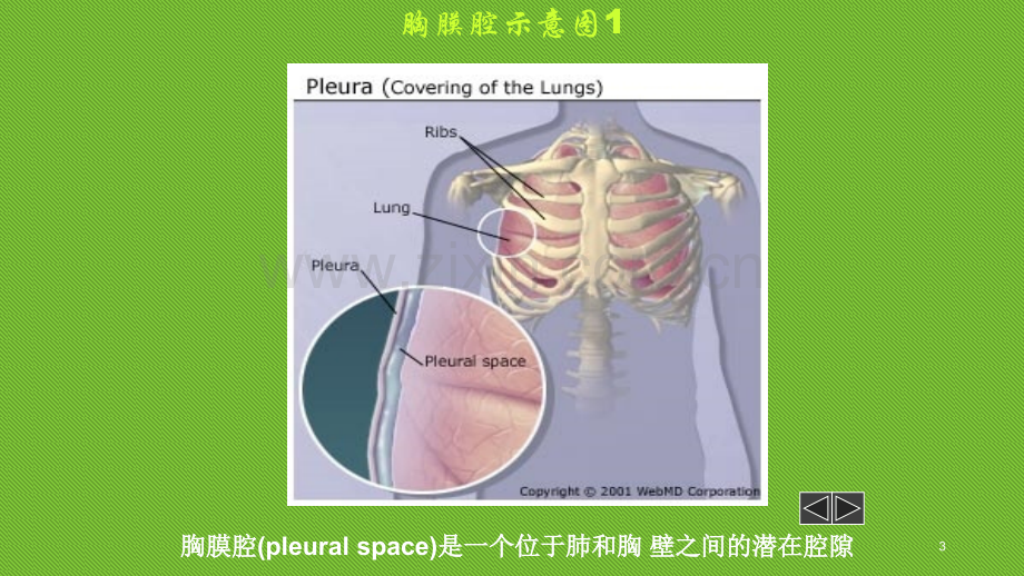 胸膜疾病胸腔积液-.ppt_第3页