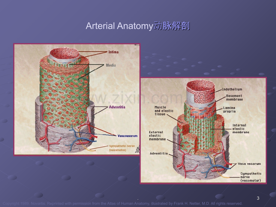 腹主动脉瘤ppt课件.ppt_第3页