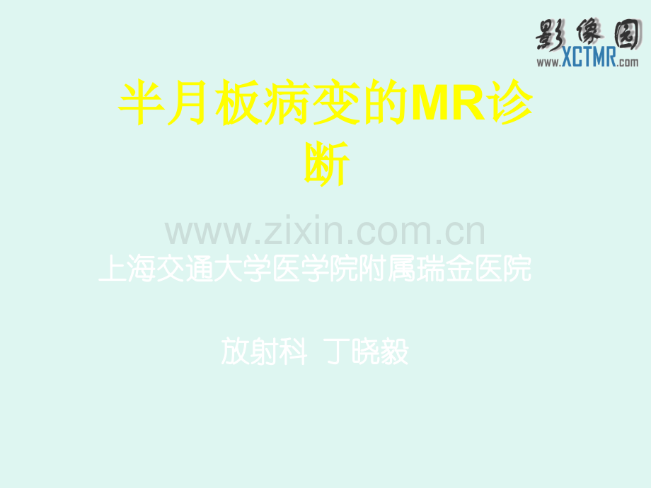 半月板病变MR诊断.ppt_第1页