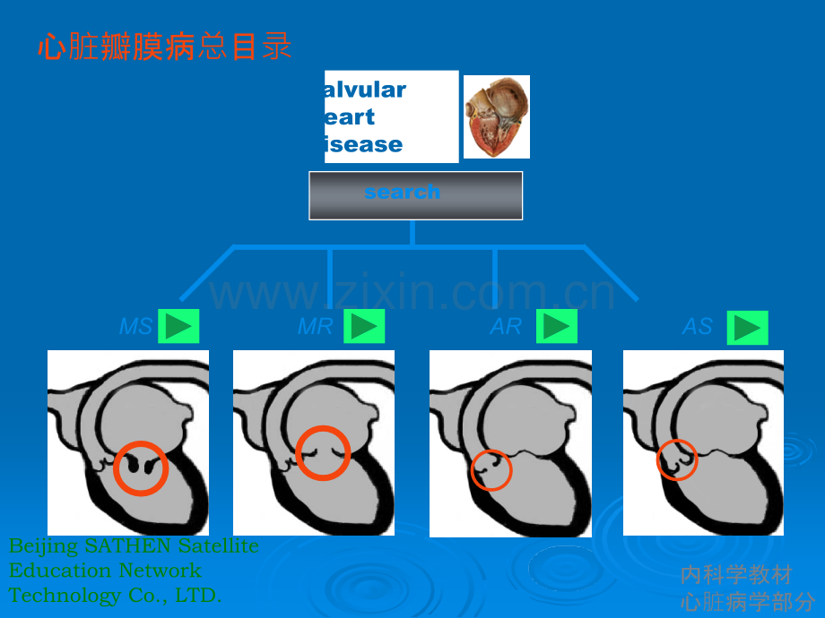 最全心脏瓣膜病课件ppt课件.ppt_第3页