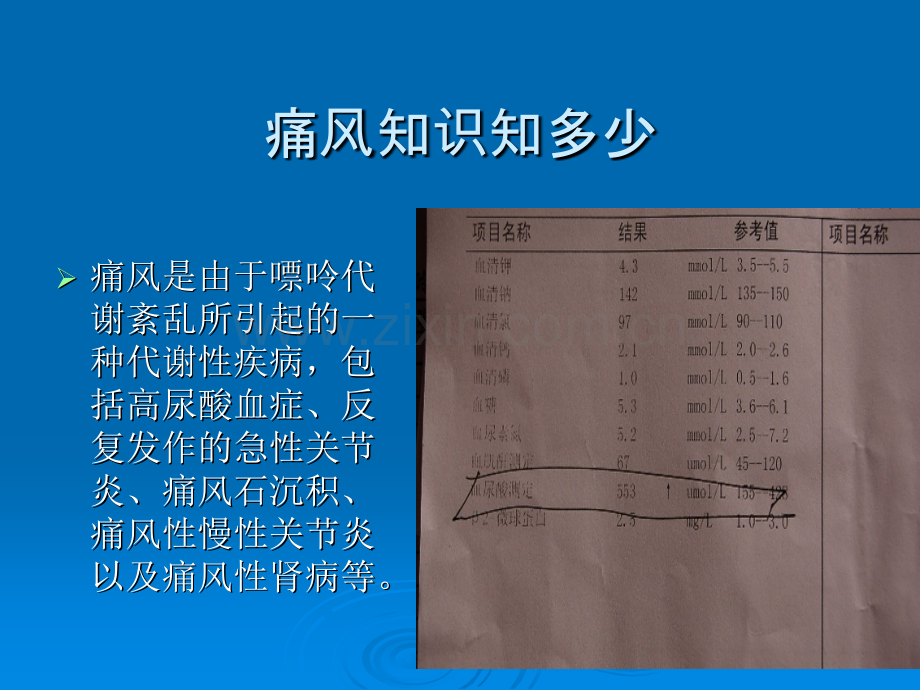 高尿酸和痛风患者的饮食管理ppt课件.pptx_第2页