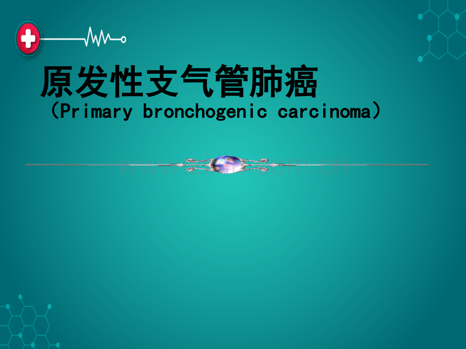 原发性支气管肺癌ppt课件.pptx_第1页