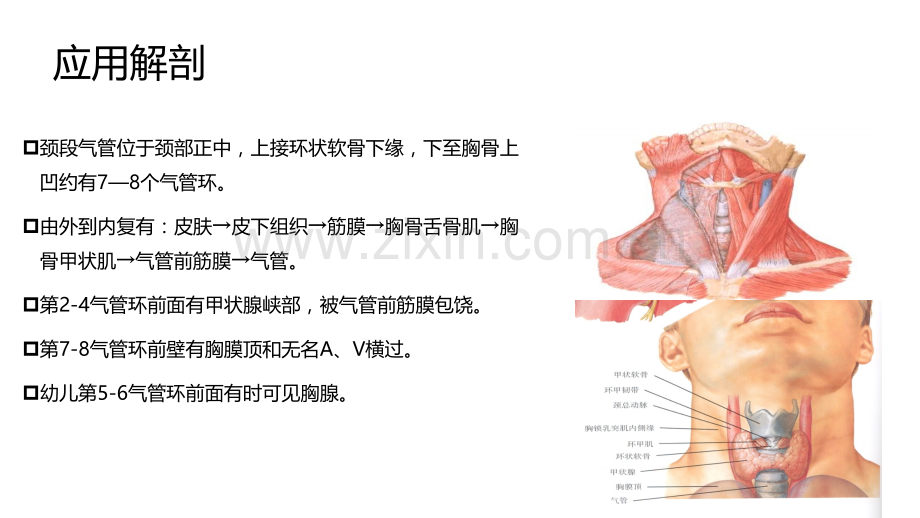 气管切开术ppt课件.pptx_第3页