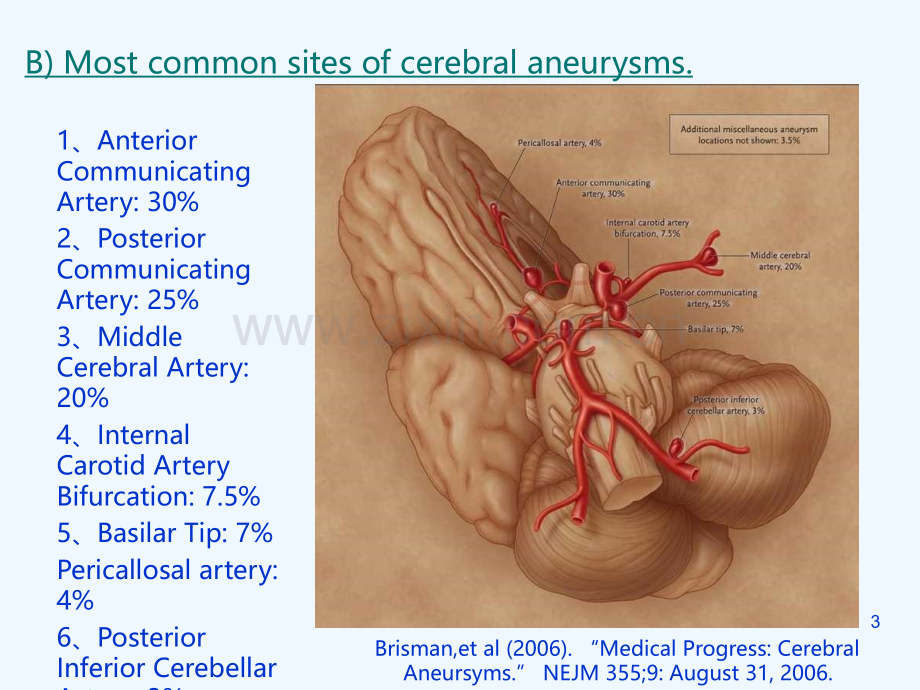 动脉瘤影像学诊断PPT课件.ppt_第3页