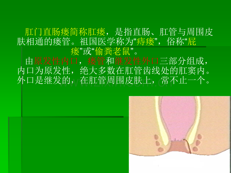 肛管直肠瘘ppt课件.ppt_第2页