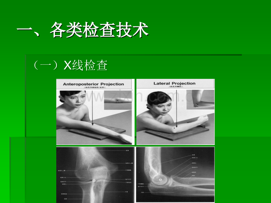 骨骼肌肉系统-1-正常与基本病变ppt课件.ppt_第3页