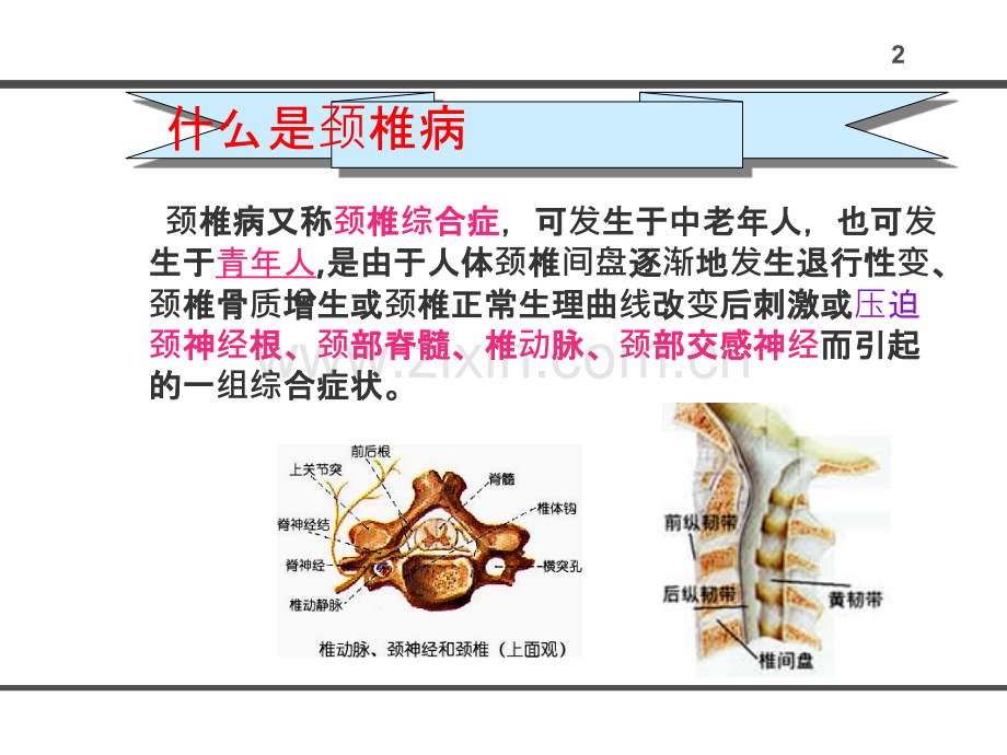 办公室人员如何防止颈椎病PPT课件.ppt_第2页