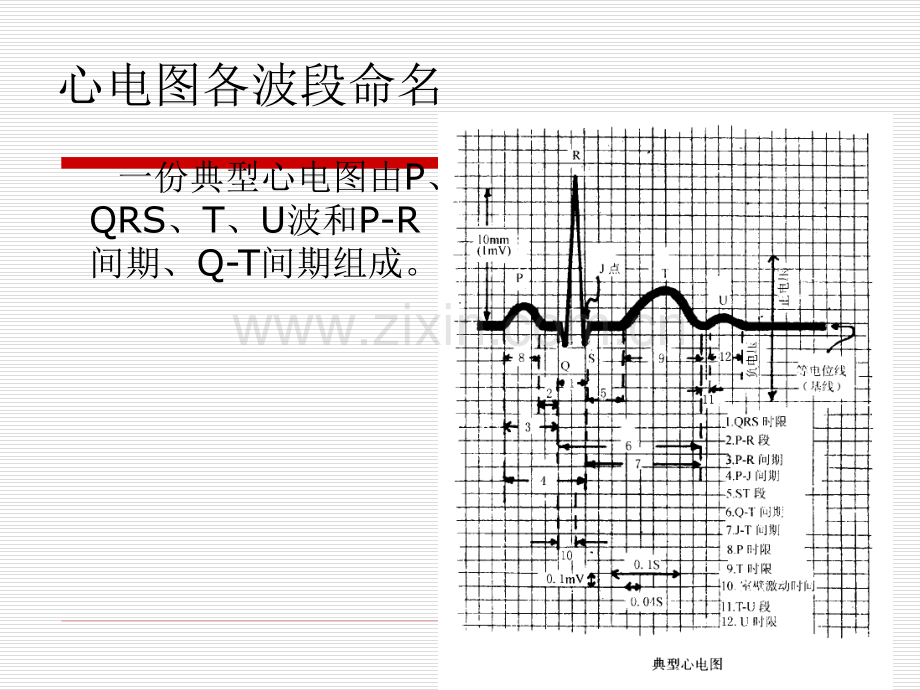 爱爱医资源-心脏疾病的心电图诊断.ppt_第3页