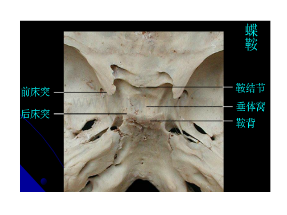 蝶鞍的解剖ppt课件.ppt_第2页