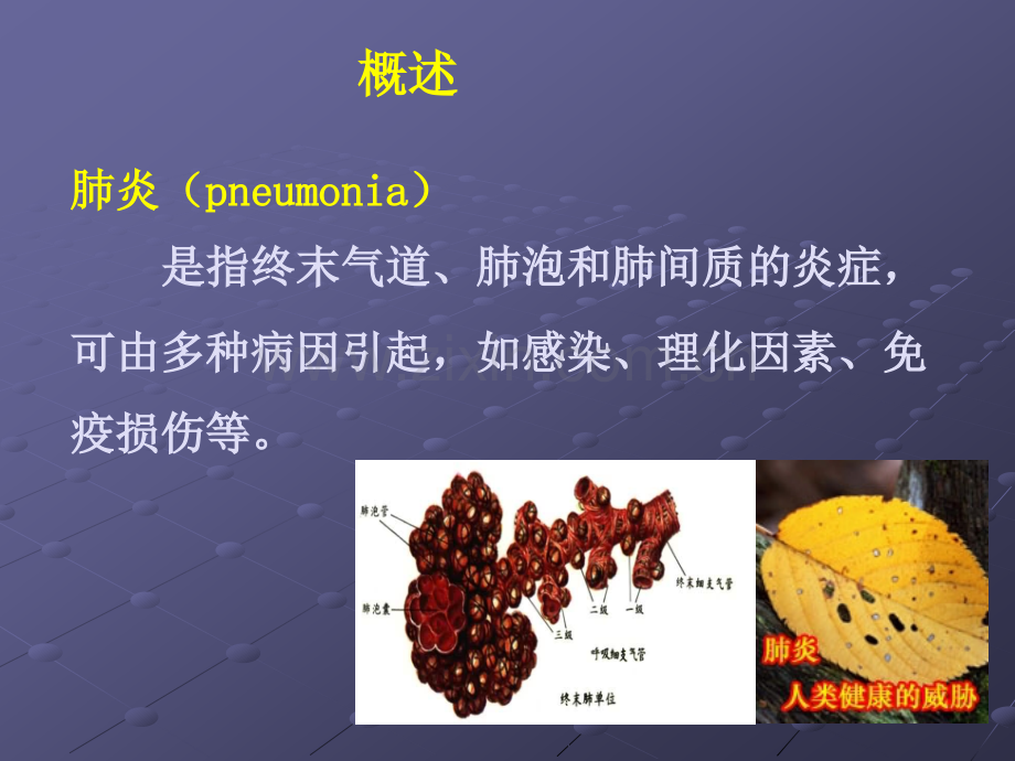 肺炎病人的护理-2ppt课件.ppt_第2页