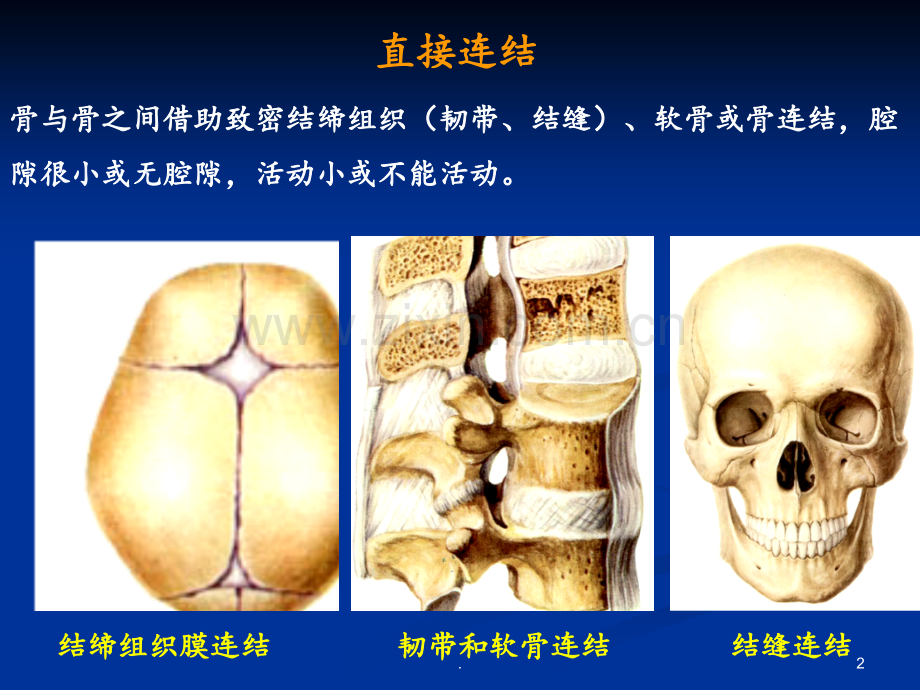 11骨连结PPT课件.ppt_第2页