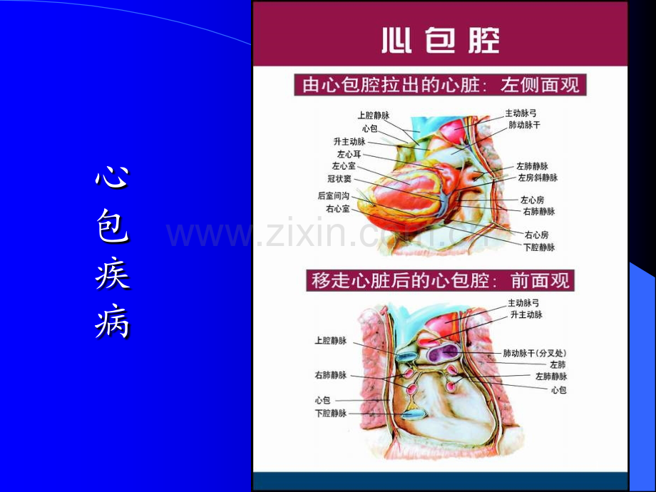 7.心包疾病PPT课件.ppt_第1页