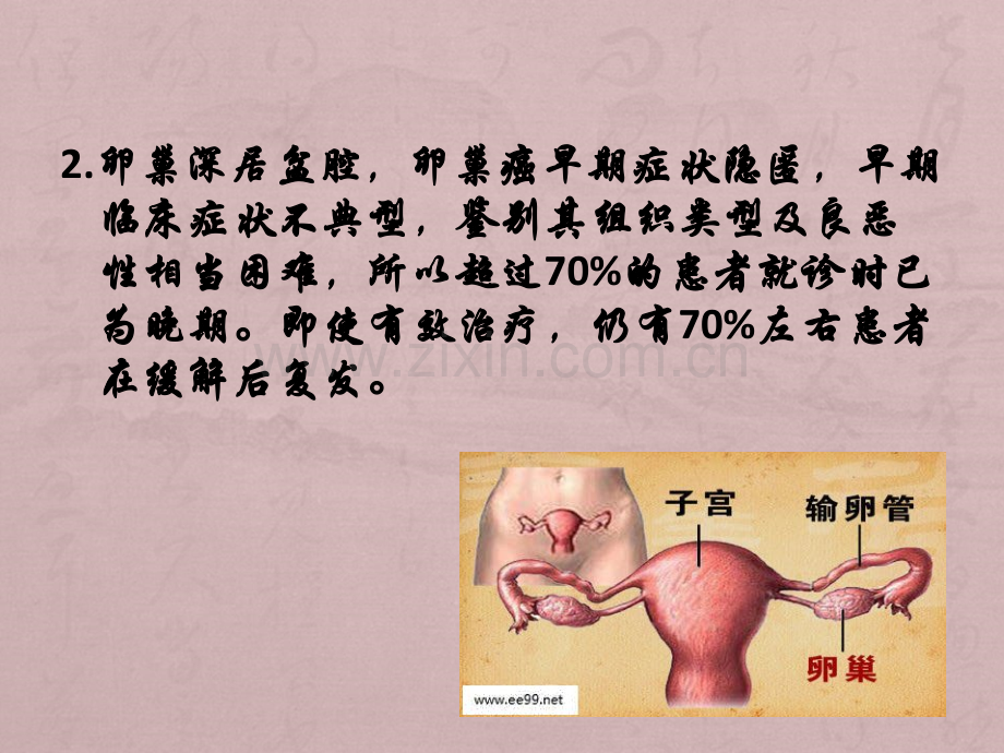 CA125与卵巢癌2016.ppt_第3页