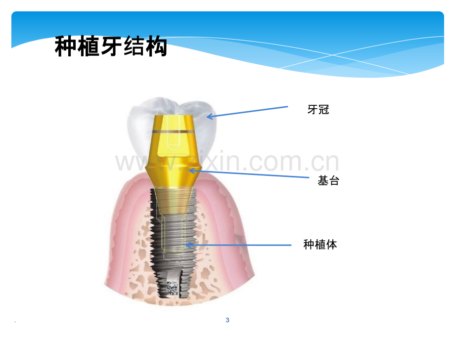 口腔专业知识培训ppt课件.pptx_第3页