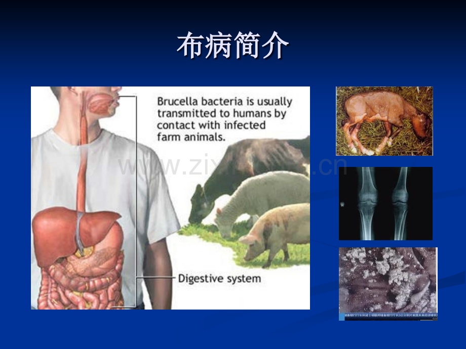 布鲁氏菌病的实验室检查.ppt_第2页