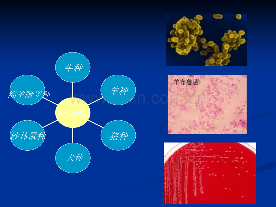 布鲁氏菌病的实验室检查.ppt_第3页