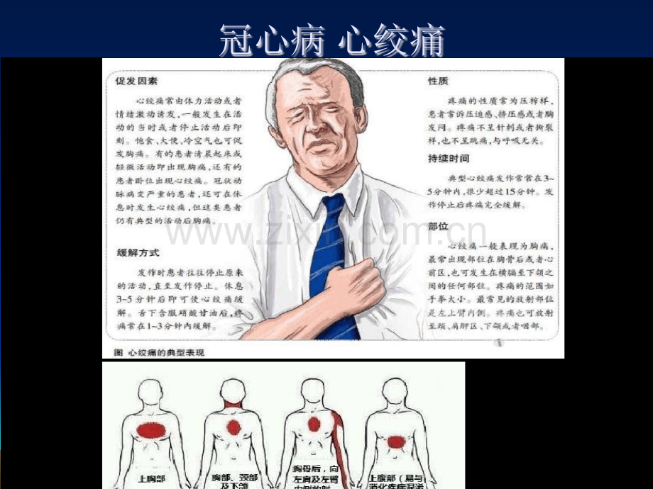 冠状动脉造影基本讲解ppt课件.pptx_第2页