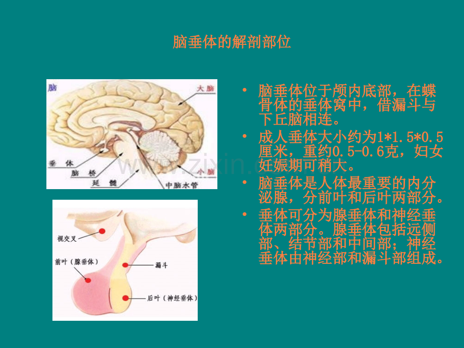 垂体瘤的围手术期护理ppt课件.ppt_第2页