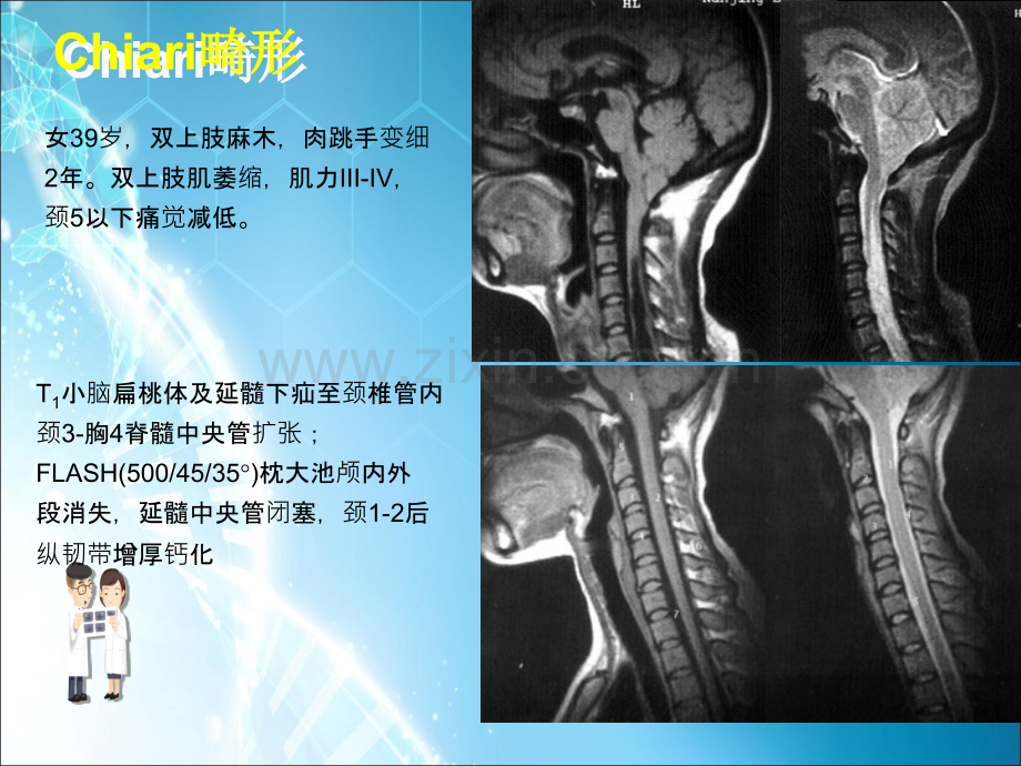 MRI图像脑-(2)ppt课件.ppt_第2页