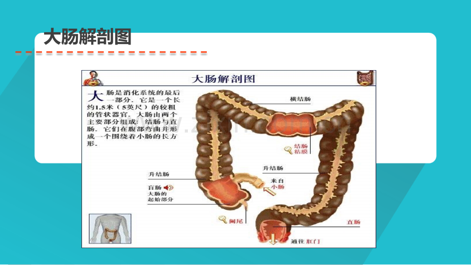 直肠癌护理查房PPT课件.pptx_第3页