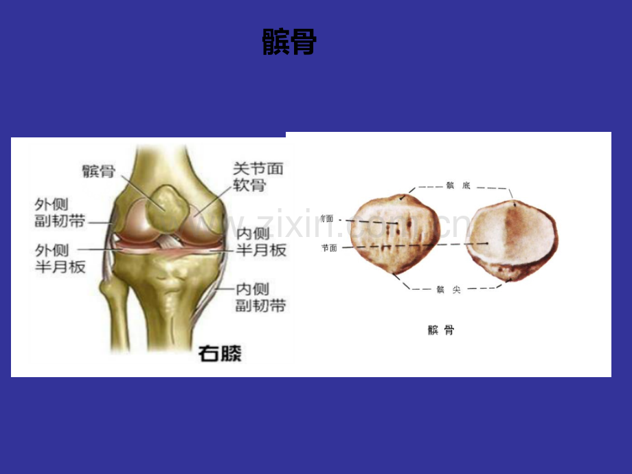 髌骨骨折护理查房.ppt_第2页