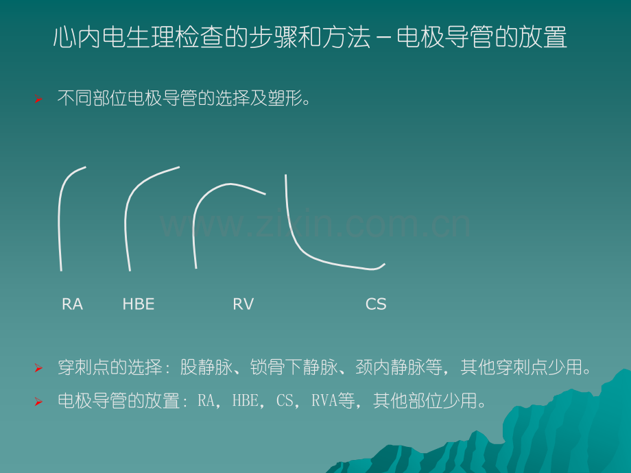 心内电生理检查方法及程序刺激.ppt_第3页