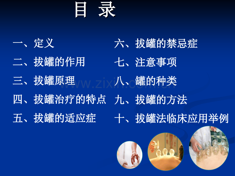 拔火罐疗法中医特色治疗ppt课件.ppt_第2页