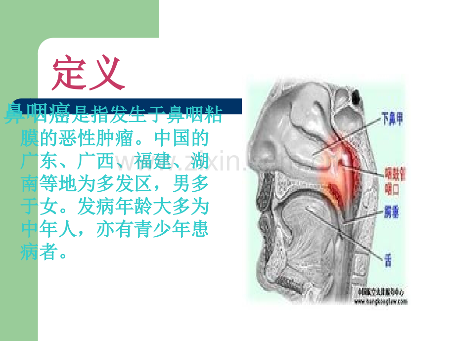 鼻咽癌病人的护理.ppt_第3页